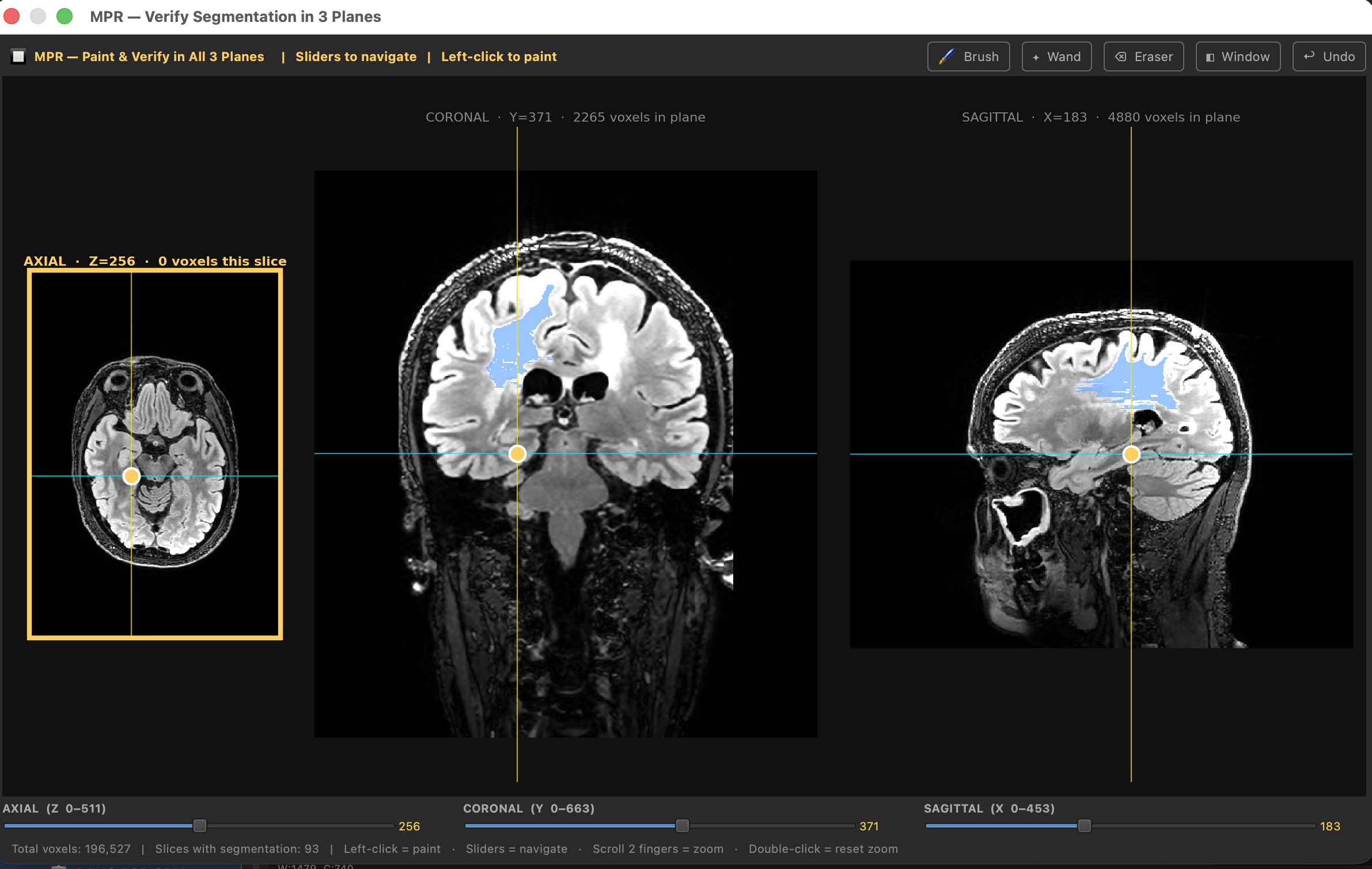 MPR 3-plane segmentation editor
