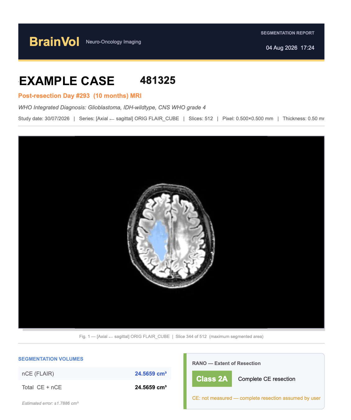 BrainVol PDF segmentation report